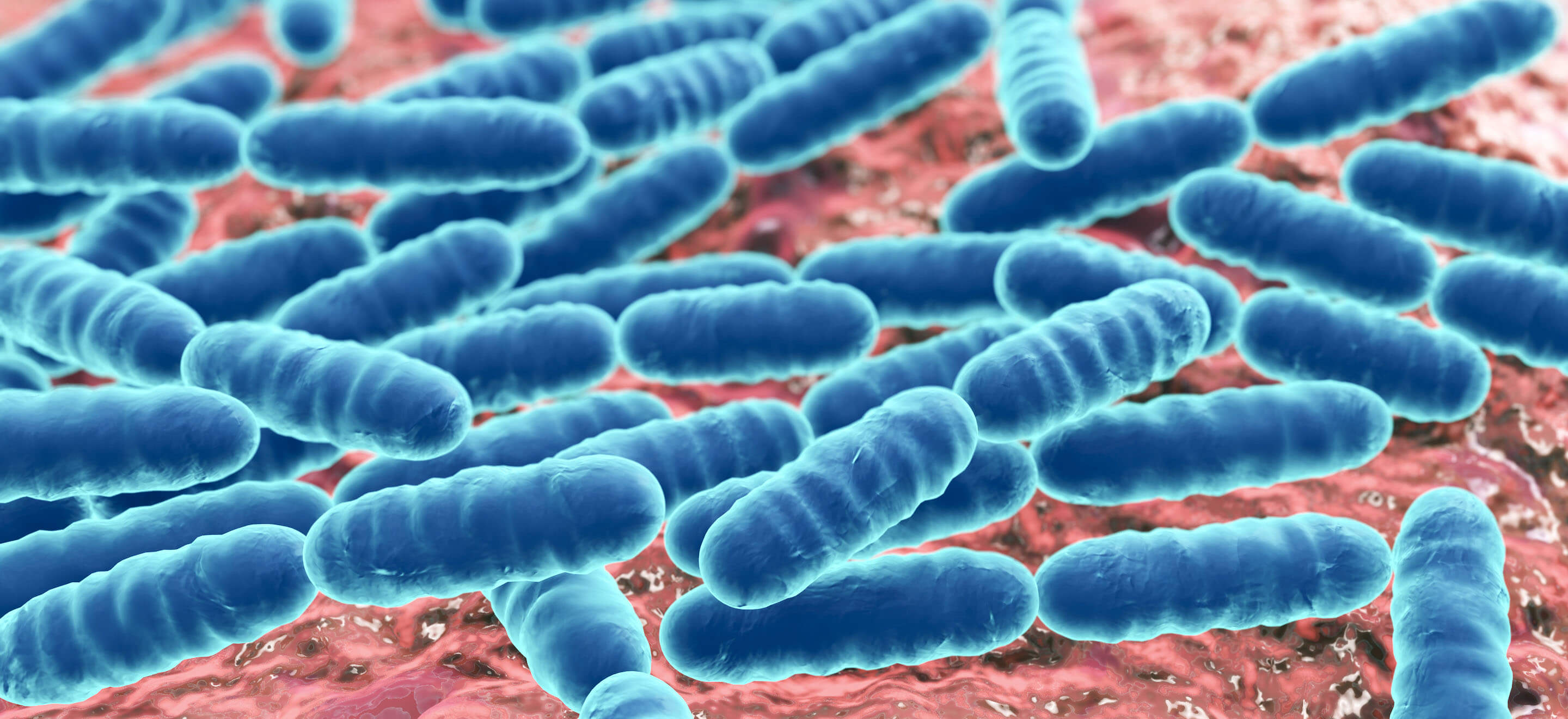 beer spoilage bacteria